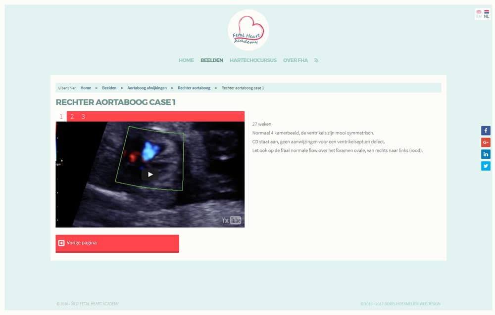 video pagina ontwerp Fetal Heart Academy